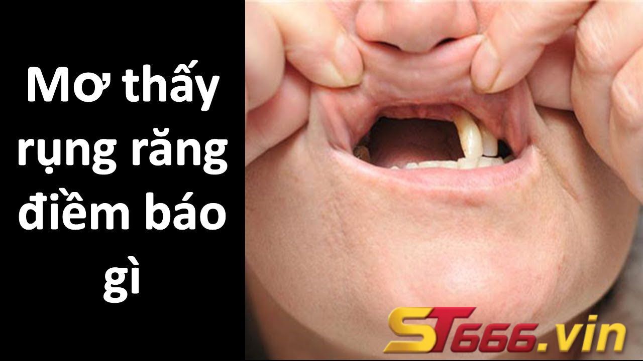 Nằm mơ thấy rụng răng đánh con gì để trúng giải cao